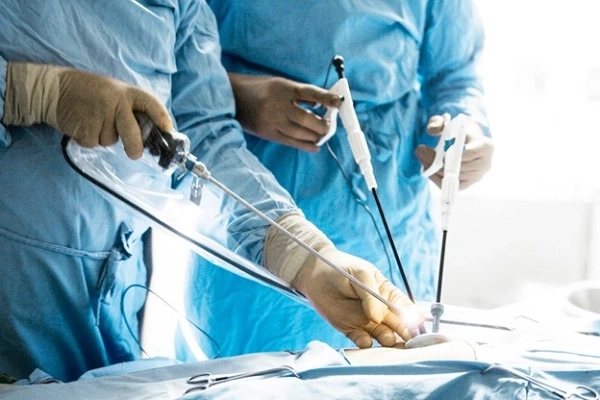 جراحی لاپاراسکوپی، مطمئن‌ترین و آسان‌ترین روش برای درمان کولیک کیسه صفرا