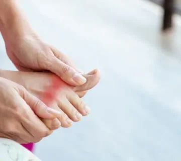 چاقی و نقرس