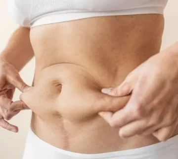 انواع جراحی چاقی