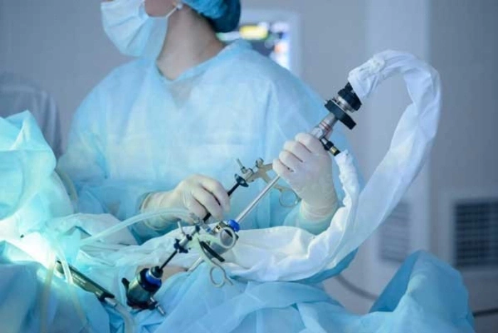 جراحی لاپاراسکوپی، روشی جدید برای انجام عمل معده برای لاغری