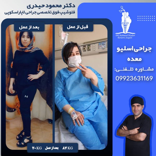دکتر محمود حیدری؛ بهترین جراح اسلیو معده
