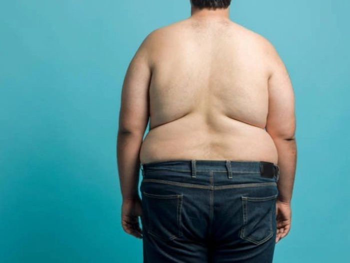 هزینه چاق ماندن بیش‌تر است یا هزینه عمل جراحی چاقی؟