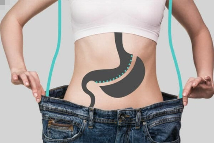 بهترین جراح چاقی در کاشان کیست؟