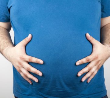 بای پس کلاسیک