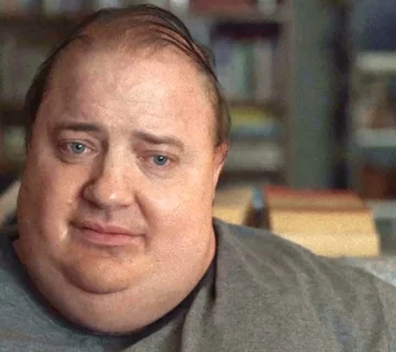 افسردگی بعد از عمل اسلیو