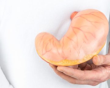 خطرات عمل بای پس معده