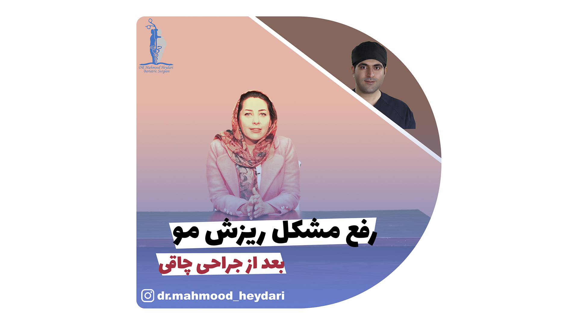 رفع مشکل ریزش مو بعد از جراحی چاقی