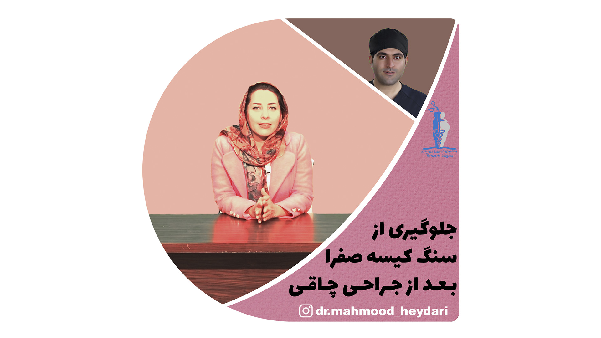 جلوگیری از سنگ کیسه صفرا بعد جراحی چاقی