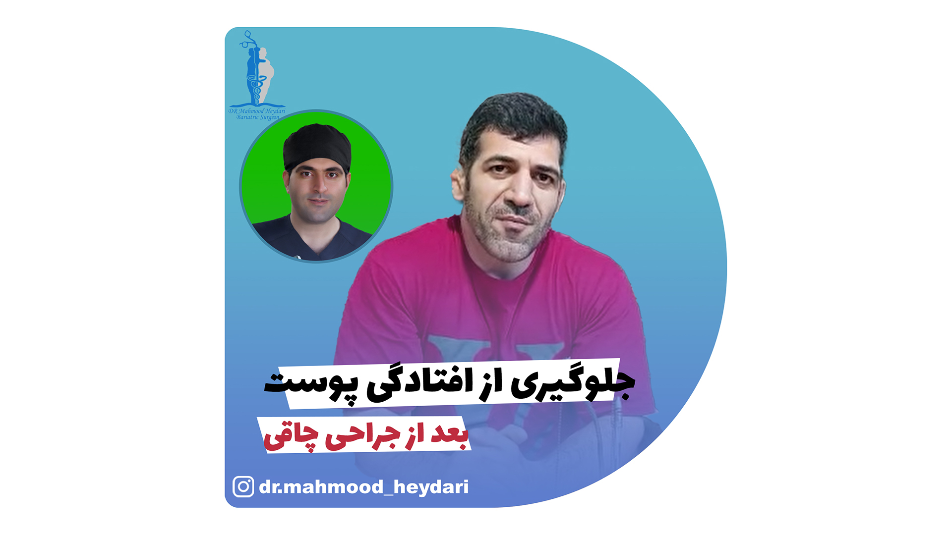 جلوگیری از افتادگی پوست بعد از عمل چاقی