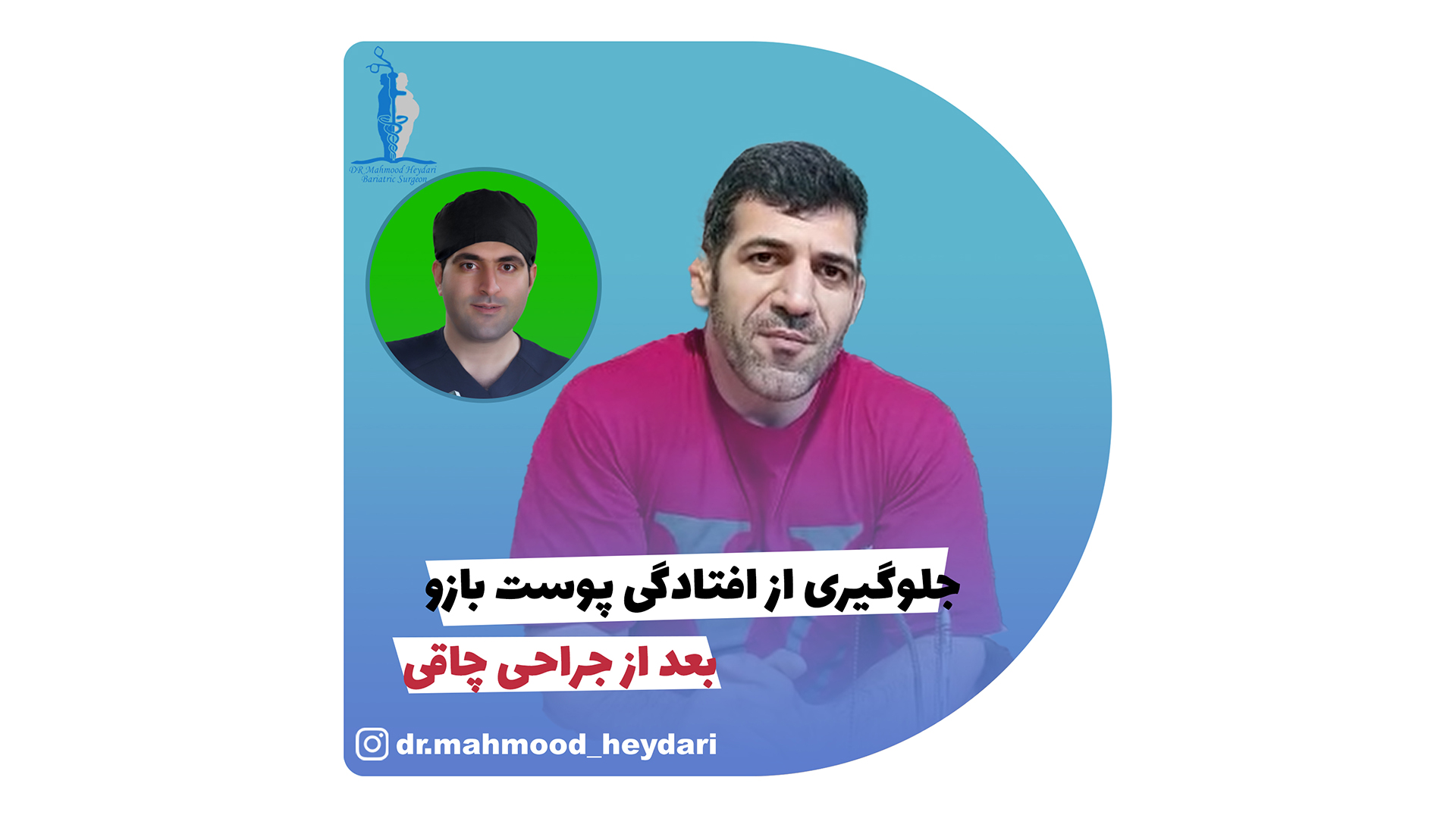 جلوگیری از افتادگی پوست بازو بعد از جراحی چاقی