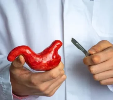 عمل مجدد اسلیو