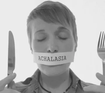 جراحی لاپاراسکوپی آشالازی