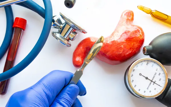 استپ وزن بعد از عمل اسلیو معده