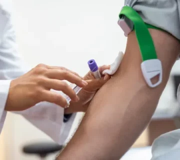 آزمایشات قبل از عمل اسلیو معده