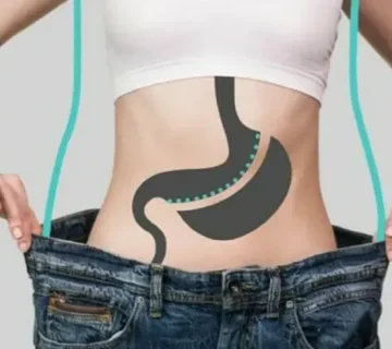 عفونت بعد از عمل اسلیو معده