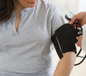 درمان فشارخون با جراحی چاقی