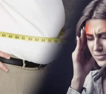 درمان میگرن با جراحی چاقی