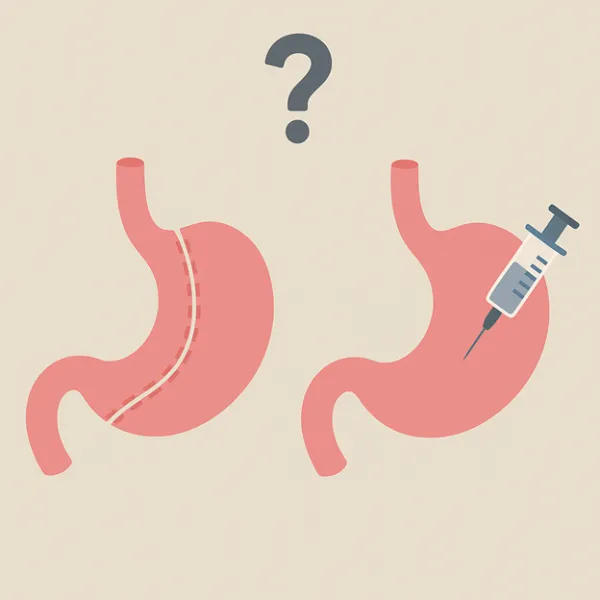 بوتاکس معده بهتر است یا اسلیو معده