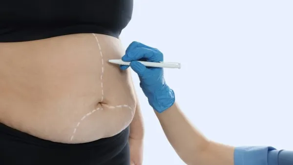 تفاوت جراحی لاغری و ابدومینوپلاستی