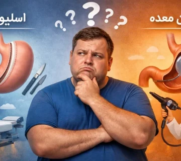 مقایسه مزایا و معایب اسلیو و بالون معده
