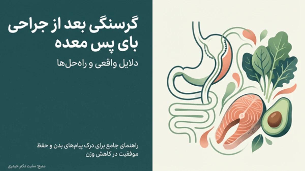 گرسنگی بعد از بای پس معده