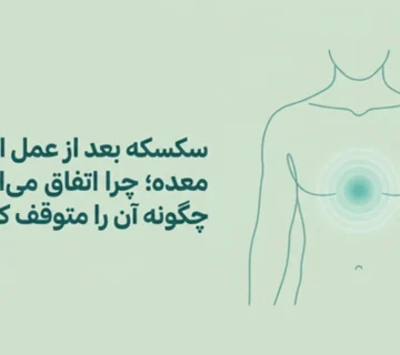 دلیل سکسکه طولانی بعد از اسلیو معده