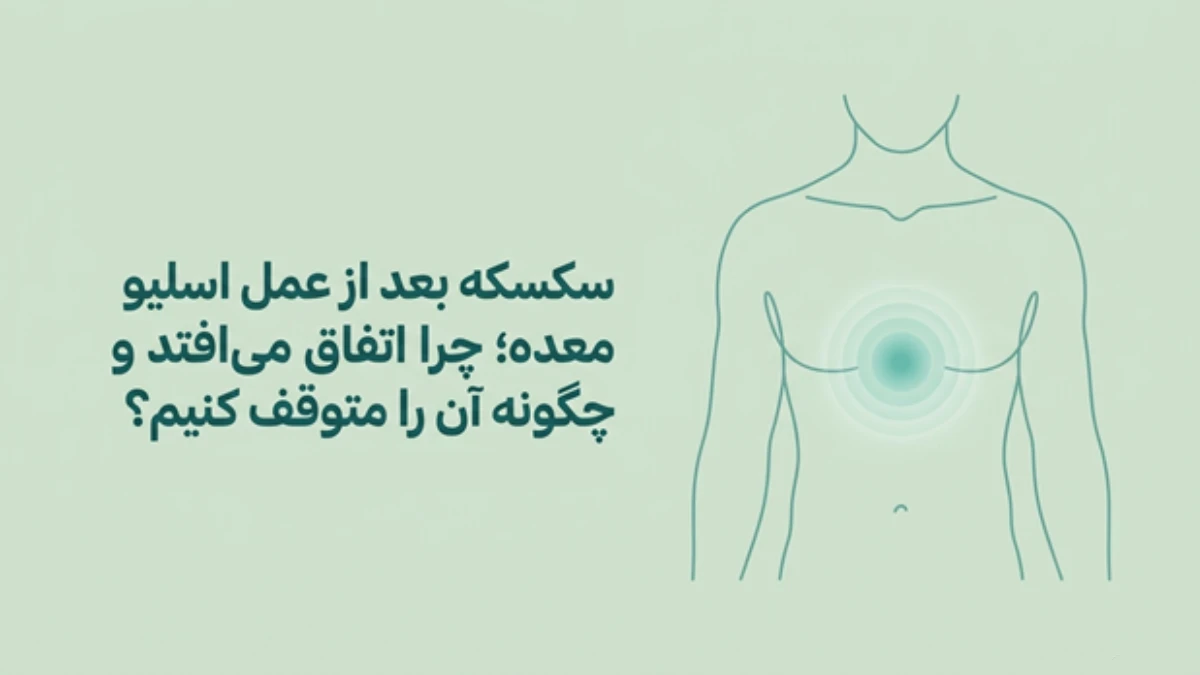دلیل سکسکه طولانی بعد از اسلیو معده