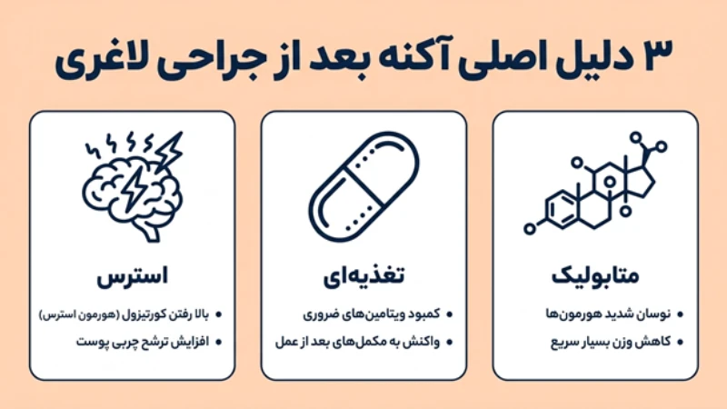 آکنه بعد از عمل اسلیو معده