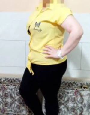 بایپس کلاسیک معده و کاهش وزن 20 کیلوگرم در 3 ماه