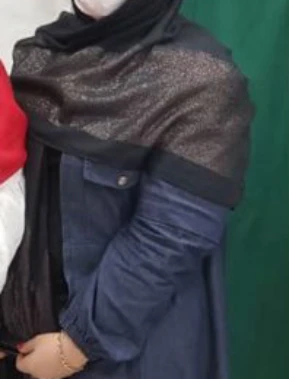 ۲۳ کیلو کاهش وزن در طول ۴ ماه در بایپس مینی معده.