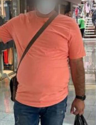 ۲۹ کیلو کاهش وزن در طول ۵ ماه بعد از جراحی اسلیو معده