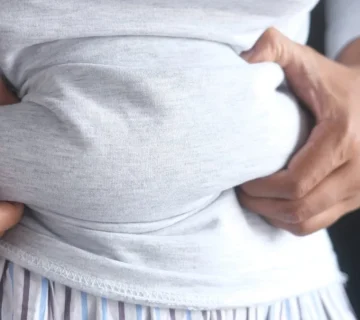 ورم و نفخ شکم بعد از اسلیو معده