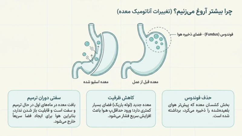 باد گلو بعد از عمل اسلیو معده