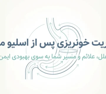 خونریزی معده بعد از عمل اسلیو معده