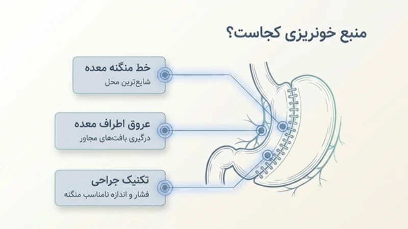 خونریزی بعد از اسلیو معده