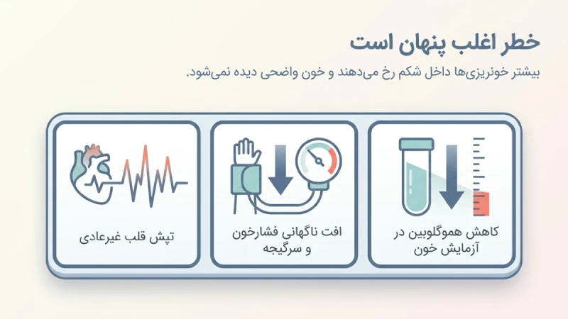 خونریزی معده بعد از اسلیو معده