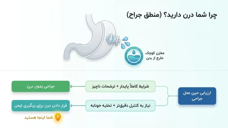 درن در عمل اسیلو معده