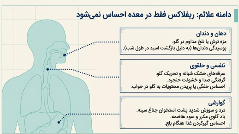 ریفلاکس معده بعد از اسلیو