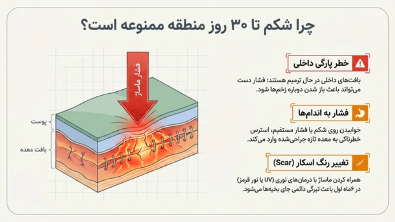 ماساژ بعد از عمل اسلیو معده
