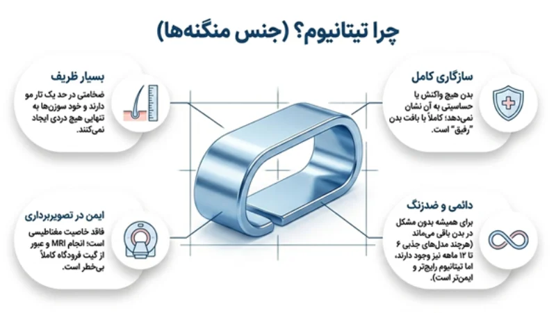 منگنه برای جراحی اسلیو معده