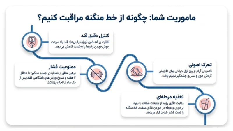 منگنه برای جراحی اسلیو معده