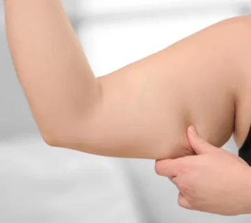 لاغری موضعی بازو