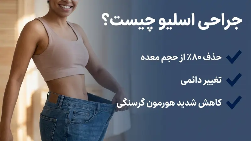 اسلیو معده چیست؟