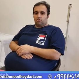 نظر بیمار کاندیدای جراحی لاغری