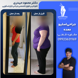 experiences-of-those-who-have-undergone-gastric-bypass-surgery-1