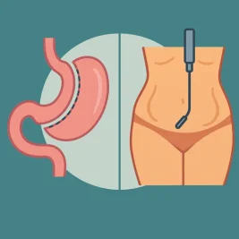 اسلیو معده بهتر است یا لیپوماتیک