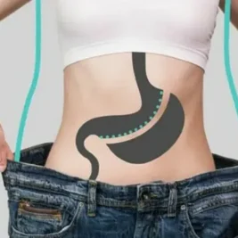 عفونت بعد از عمل اسلیو معده