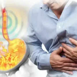 لاپاراسکوپی رفلاکس معده