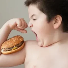 چاقی در کودکان