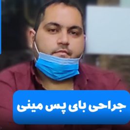 نظر بیمار در مورد عمل مینی بای پس معده